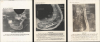 1943-44 World War II-Era Aerial Attack Archive of Kwajalein Atoll